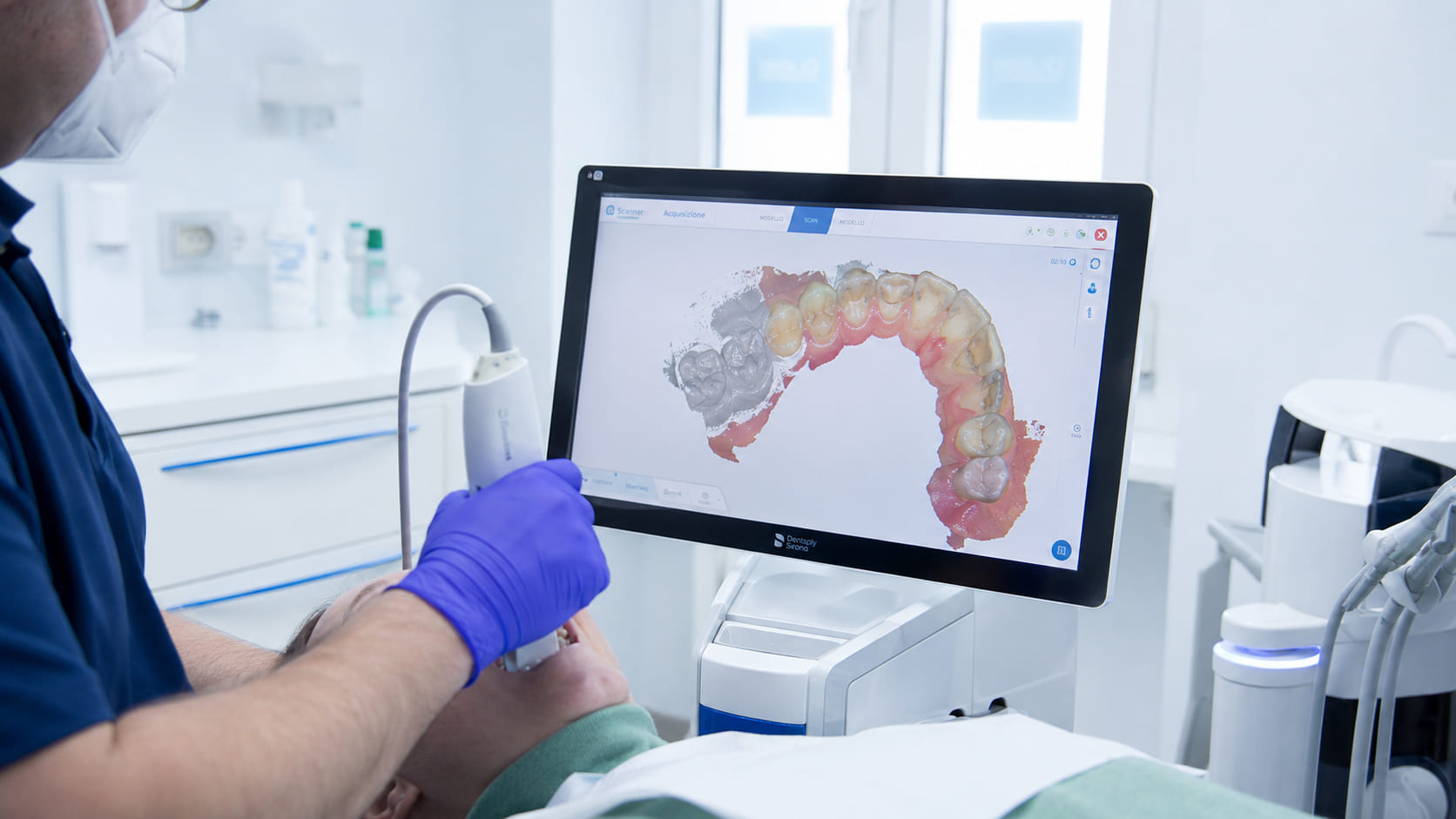 Lo scanner intraorale in mano all'operatore e il modello 3D che si costruisce sullo schermo.
